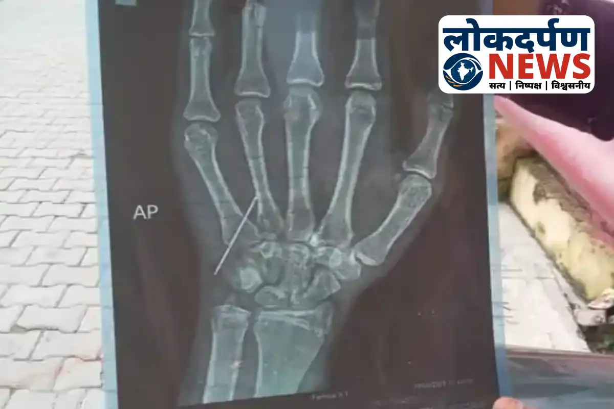 Broken injection needle stuck in minor girl’s hand in Gorakhpur hospital negligence case