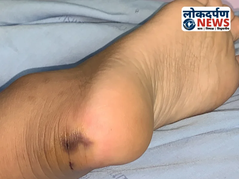 Gorakhpur गोरखपुर में सांप के काटने से अधेड़ की मौत, परिवार में शोक की लहर